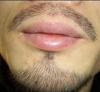 胡子容易长是怎么回事(为什么会有人胡子容易长呢？)