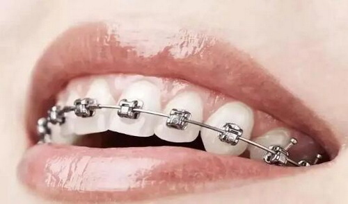 修复牙齿要用什么材料【修复牙齿要用什么药】