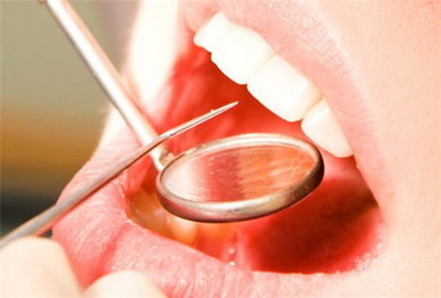 牙齿贴面的过程是怎样的