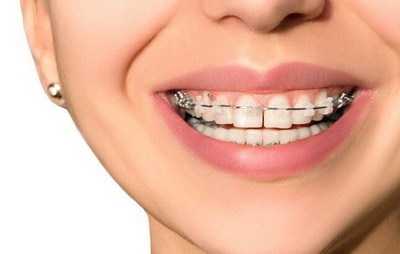 敏感牙齿怎么修复