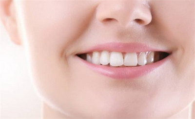 种植牙的材料有几种(不同材料的种植牙)