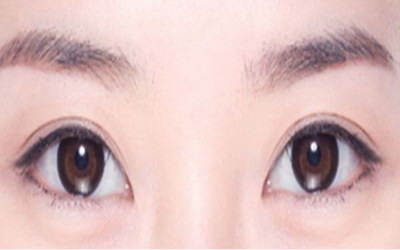 淡化黑眼圈的眼膜