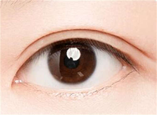 2023年凌源市韩式双眼皮技术大咖医院,凌源市韩式双眼皮权威整形医院排名榜!