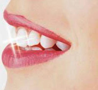 怎么可以让牙龈不萎缩